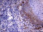 PIK3C2A Antibody in Immunohistochemistry (Paraffin) (IHC (P))