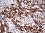 PIK3C2A Antibody in Immunohistochemistry (Paraffin) (IHC (P))