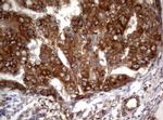 PIK3C2A Antibody in Immunohistochemistry (Paraffin) (IHC (P))