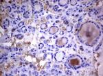 PIK3C2A Antibody in Immunohistochemistry (Paraffin) (IHC (P))