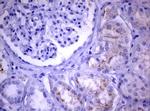 PIK3C2A Antibody in Immunohistochemistry (Paraffin) (IHC (P))