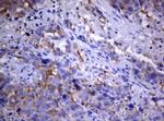 PIK3C2A Antibody in Immunohistochemistry (Paraffin) (IHC (P))