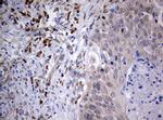 PIK3C2A Antibody in Immunohistochemistry (Paraffin) (IHC (P))