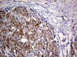 PIK3C2A Antibody in Immunohistochemistry (Paraffin) (IHC (P))