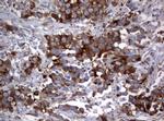 PIK3C2A Antibody in Immunohistochemistry (Paraffin) (IHC (P))