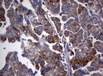 PIK3C2A Antibody in Immunohistochemistry (Paraffin) (IHC (P))