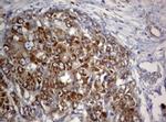 PIK3C2A Antibody in Immunohistochemistry (Paraffin) (IHC (P))