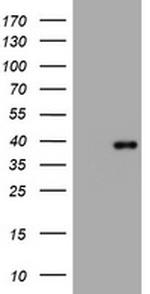 PIK3C2A Antibody in Western Blot (WB)