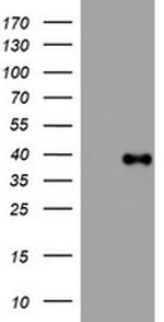 PIK3C2A Antibody in Western Blot (WB)