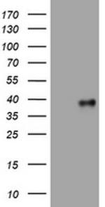 PIK3C2A Antibody in Western Blot (WB)
