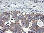 PIK3C2B Antibody in Immunohistochemistry (Paraffin) (IHC (P))