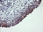 PIK3C2B Antibody in Immunohistochemistry (Paraffin) (IHC (P))