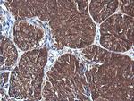PIK3C2B Antibody in Immunohistochemistry (Paraffin) (IHC (P))