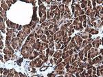 PIK3C2B Antibody in Immunohistochemistry (Paraffin) (IHC (P))