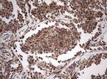 PIK3CA Antibody in Immunohistochemistry (Paraffin) (IHC (P))