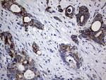 PIK3CD Antibody in Immunohistochemistry (Paraffin) (IHC (P))