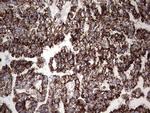 PIK3CD Antibody in Immunohistochemistry (Paraffin) (IHC (P))