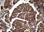 PIK3CD Antibody in Immunohistochemistry (Paraffin) (IHC (P))