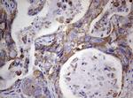 PIK3CD Antibody in Immunohistochemistry (Paraffin) (IHC (P))
