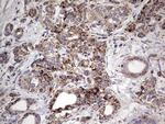 PIK3CD Antibody in Immunohistochemistry (Paraffin) (IHC (P))