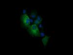 PIK3CG Antibody in Immunocytochemistry (ICC/IF)