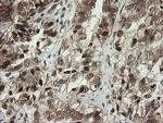 PIK3CG Antibody in Immunohistochemistry (Paraffin) (IHC (P))