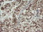PIK3CG Antibody in Immunohistochemistry (Paraffin) (IHC (P))