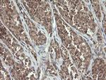 PIK3CG Antibody in Immunohistochemistry (Paraffin) (IHC (P))