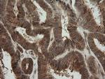 PIK3CG Antibody in Immunohistochemistry (Paraffin) (IHC (P))