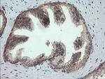 PIK3CG Antibody in Immunohistochemistry (Paraffin) (IHC (P))