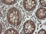 PIK3CG Antibody in Immunohistochemistry (Paraffin) (IHC (P))