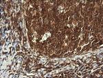 PIK3CG Antibody in Immunohistochemistry (Paraffin) (IHC (P))