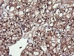 PIK3CG Antibody in Immunohistochemistry (Paraffin) (IHC (P))