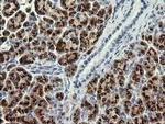 PIK3CG Antibody in Immunohistochemistry (Paraffin) (IHC (P))