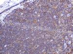PIK3CG Antibody in Immunohistochemistry (Paraffin) (IHC (P))