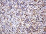 PIK3CG Antibody in Immunohistochemistry (Paraffin) (IHC (P))
