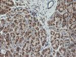 PIK3CG Antibody in Immunohistochemistry (Paraffin) (IHC (P))
