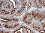 PIK3CG Antibody in Immunohistochemistry (Paraffin) (IHC (P))