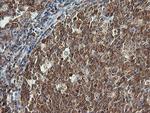 PIK3CG Antibody in Immunohistochemistry (Paraffin) (IHC (P))