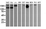 PIK3CG Antibody in Western Blot (WB)