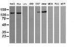 PIK3CG Antibody in Western Blot (WB)