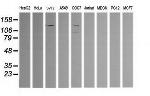 PIK3CG Antibody in Western Blot (WB)