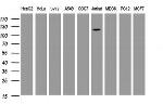 PIK3CG Antibody in Western Blot (WB)