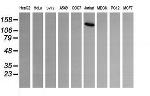 PIK3CG Antibody in Western Blot (WB)
