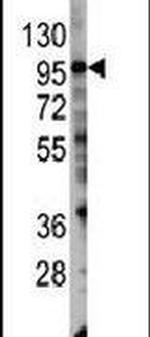 PIK3CG Antibody in Western Blot (WB)