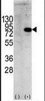 PI3K p85 alpha Antibody in Western Blot (WB)