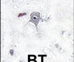 PIK3R2 Antibody in Immunohistochemistry (IHC)