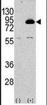 PIK3R2 Antibody in Western Blot (WB)