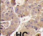 PI3K p55 gamma Antibody in Immunohistochemistry (IHC)