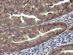 PIK3R5 Antibody in Immunohistochemistry (Paraffin) (IHC (P))